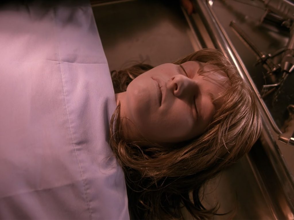 Laura Palmer's body on the autopsy table