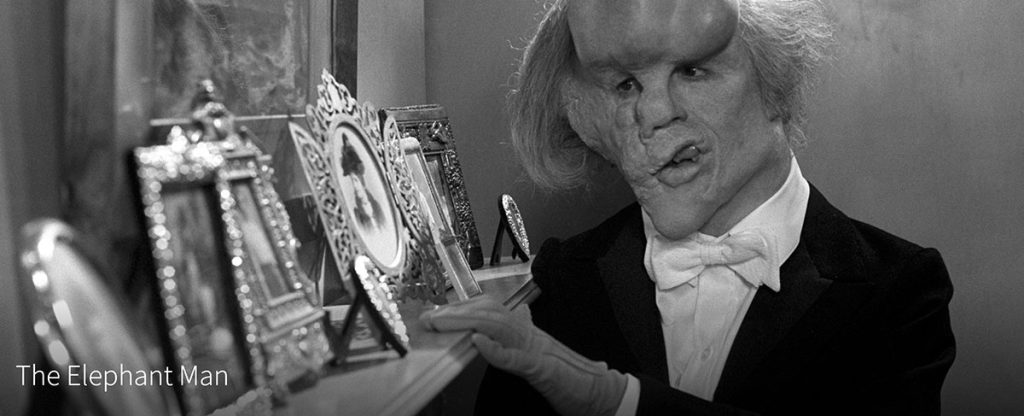 The Elephant Man