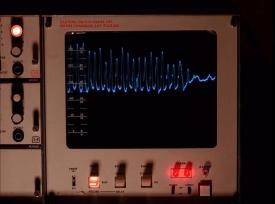 18_TPB_Vacant_Calhoun_1007_EKG04